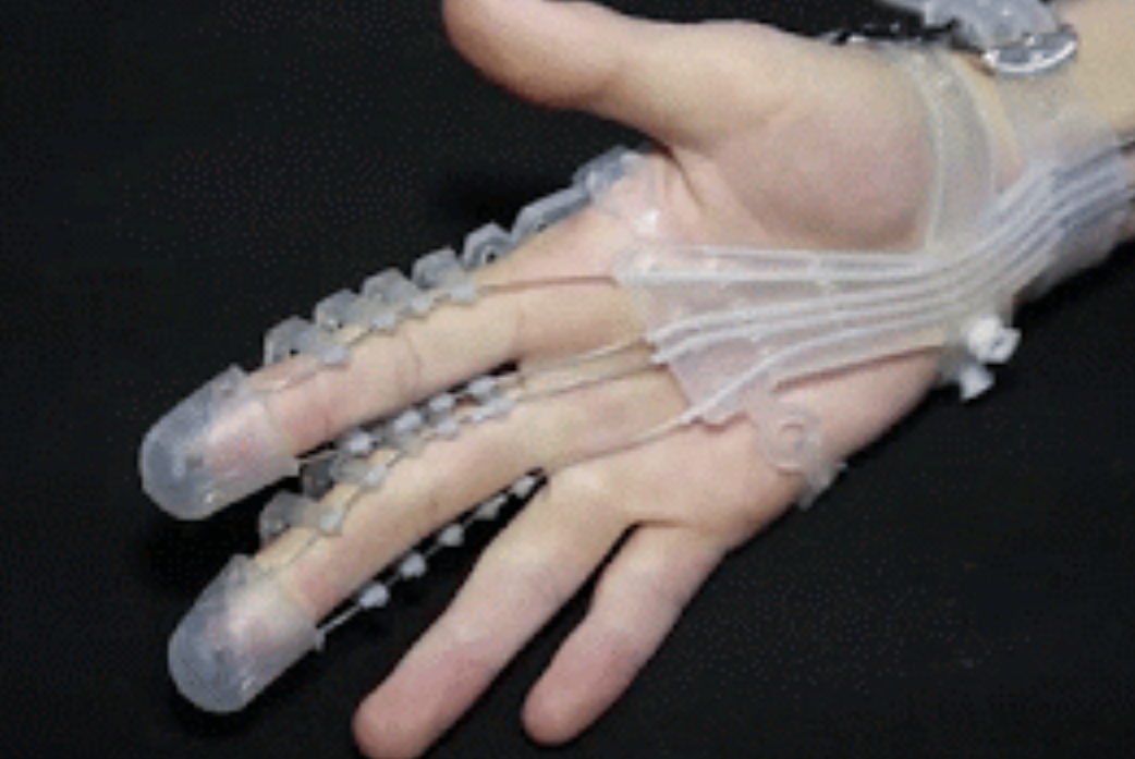 Photograph of a hand wearing the translucent soft robotic grip assist glove, with tendon guides along the index and middle fingers